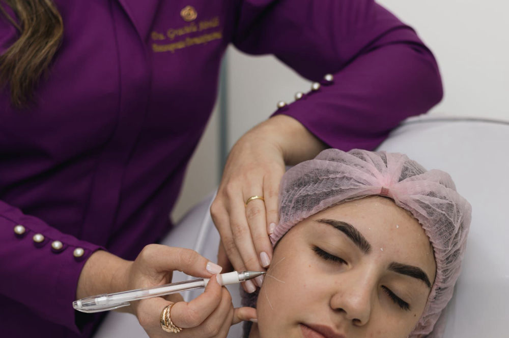 Planejamento Facial com Ácido hialurônico e preenchimento